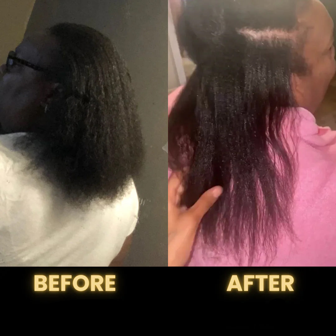 SEAGRIL Scalp Stimulator | Hair Growth Oil