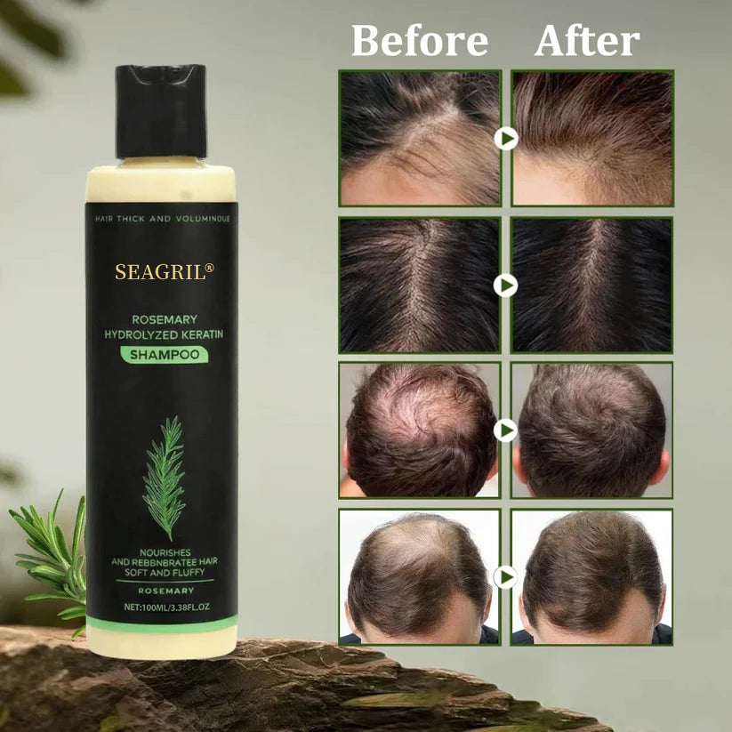 🌱SEAGRIL® Hair growth shampoo , Unlock the Secret to Thicker, Healthier-Looking Hair