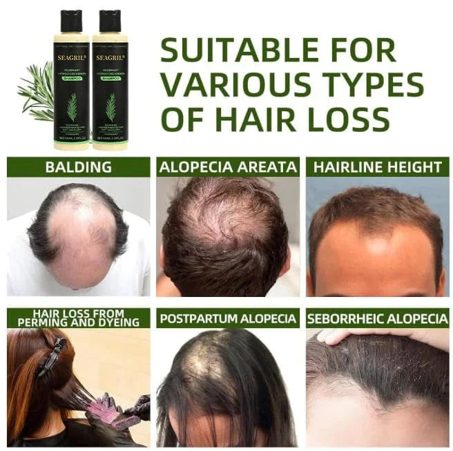🌱SEAGRIL® Hair growth shampoo , Unlock the Secret to Thicker, Healthier-Looking Hair