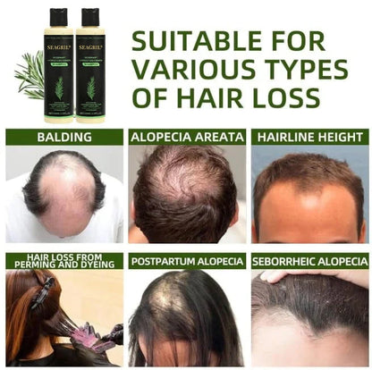 🌱SEAGRIL® Hair growth shampoo , Unlock the Secret to Thicker, Healthier-Looking Hair