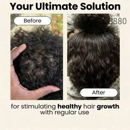 SEAGRIL Scalp Stimulator | Hair Growth Oil