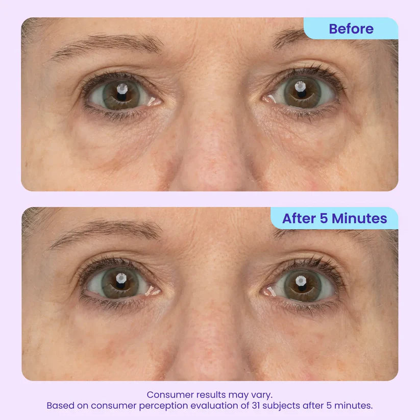 💜Instant Lift Eye Gel - For Puffiness & Bags, Wrinkles, Fine Lines and Dark Circles, Anti Aging Skin Care for Men & Women.