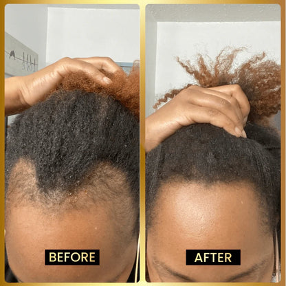SEAGRIL Scalp Stimulator | Hair Growth Oil