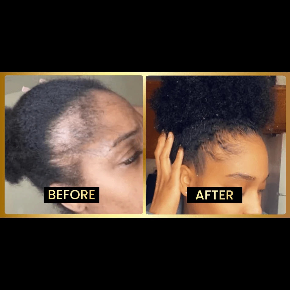 SEAGRIL Scalp Stimulator | Hair Growth Oil