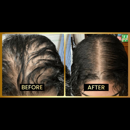 SEAGRIL Scalp Stimulator | Hair Growth Oil