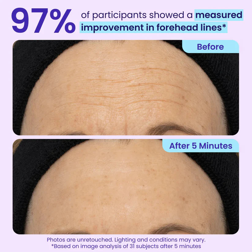 💜Instant Lift Eye Gel - For Puffiness & Bags, Wrinkles, Fine Lines and Dark Circles, Anti Aging Skin Care for Men & Women.