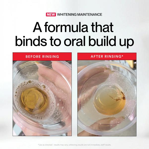 【👑Top Sellers of 2026】✨ TIWORLD Stain Whitening Mouthwash 🌿 | Brighten Your Smile & Freshen Your Breath with Essential Oils 🦷🌬️