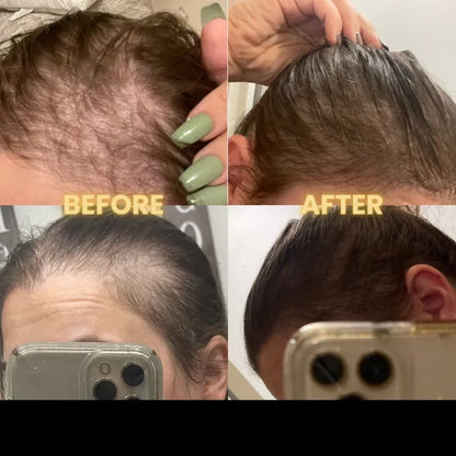SEAGRIL Scalp Stimulator | Hair Growth Oil