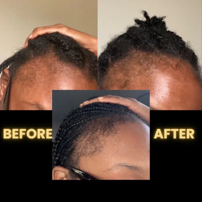 SEAGRIL Scalp Stimulator | Hair Growth Oil